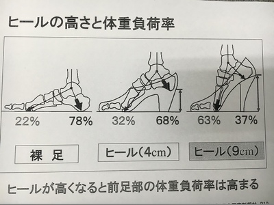 島ぞうり　アート　シマトネリコ！