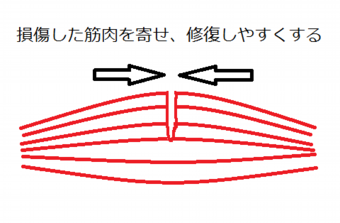 肉離れ!