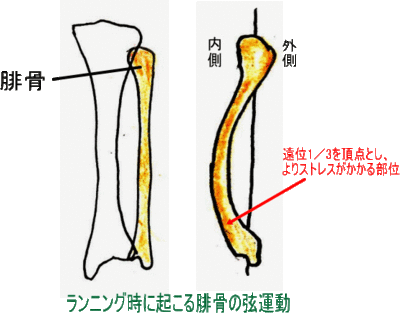 骨折、脱臼について!