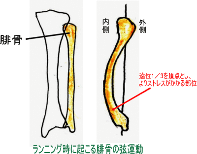 骨折、脱臼について！