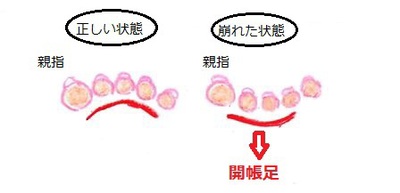 足のトラボー(トラブル)！