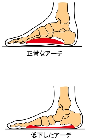 足のトラボー(トラブル)！